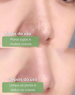 Máscara de Chá Verde  Limpeza Profunda Cravos e Espinhas