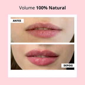 KIT Lábios Perfeitos & Volumosos Naturalmente
