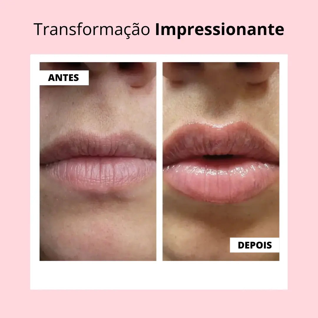 KIT Lábios Perfeitos & Volumosos Naturalmente