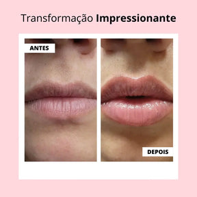 KIT Lábios Perfeitos & Volumosos Naturalmente